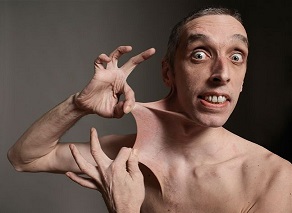 Colágeno vs Ácido Hialurónico Ehlers Danlos