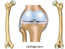 Para qué es colágeno cartílago