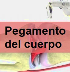 Pegamento del cuerpo